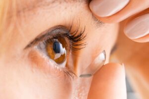 Sjogren's Syndrome and Scleral Lenses