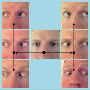 Broad H test in ocular motility